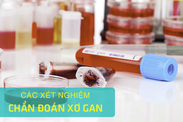 Có những loại xét nghiệm khác nhau ngoài xét nghiệm máu để đánh giá xơ gan không?
