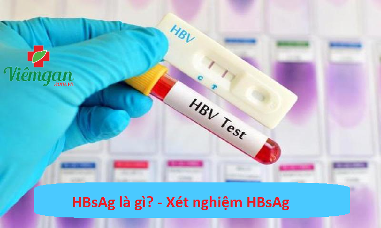Dấu hiệu nào cho thấy cần xét nghiệm miễn dịch HBsAg? 
