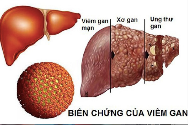 1. Sử dụng thuốc kháng virus – Không phải ai cũng cần sử dụng thuốc này 1