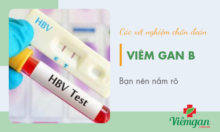 Xét nghiệm viêm gan B cần làm những gì, có cần nhịn ăn ? 1