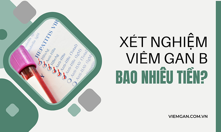 Xét nghiệm viêm gan B bao nhiêu tiền? Bảng giá chi tiết 1