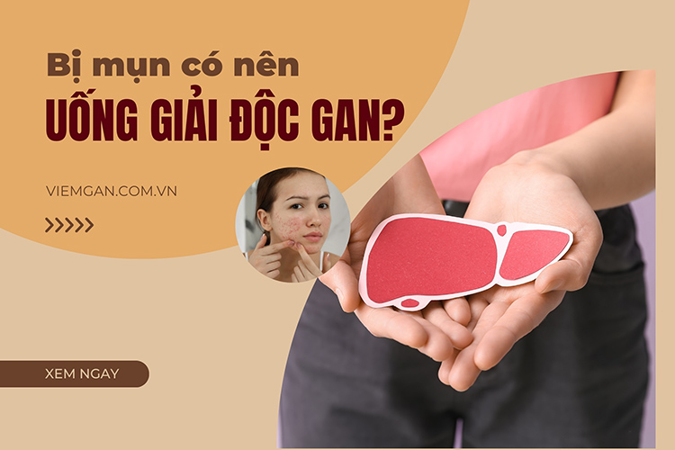 Bị mụn uống giải độc gan có hết không? Lưu ý khi dùng 1