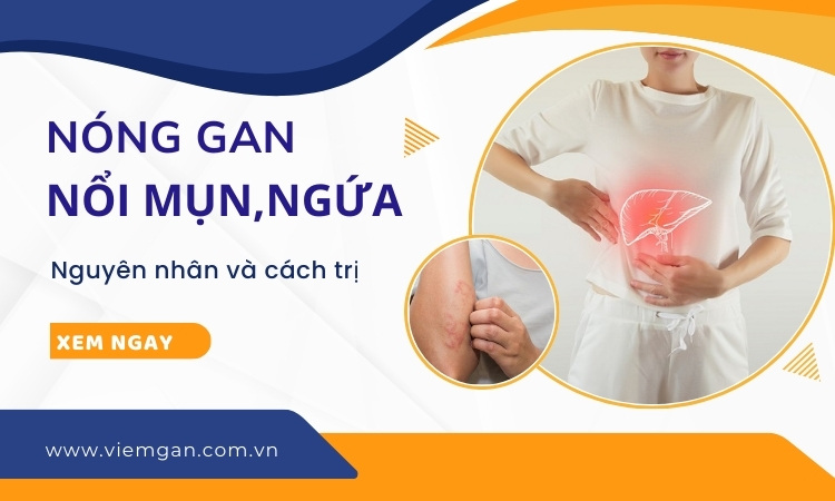 Nóng gan, nổi mụn, ngứa - Nguyên nhân, cách trị 1