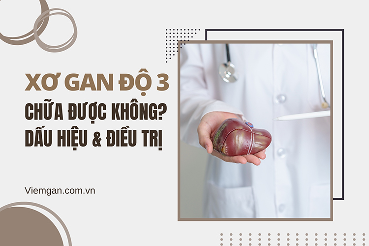 Xơ gan độ 3 có chữa được không? Dấu hiệu và cách điều trị 1